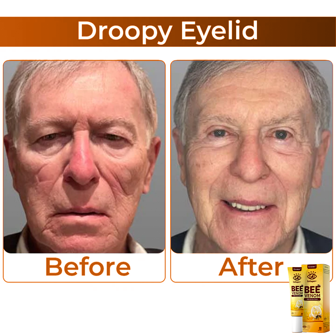 Bee Venom+Collagen: Awaken your gaze