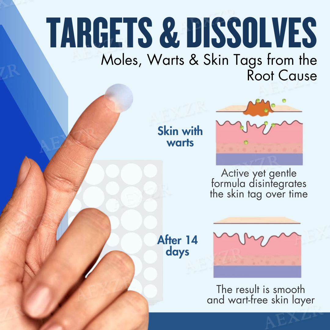 Patch – Effective removal of beauty spots and warts 