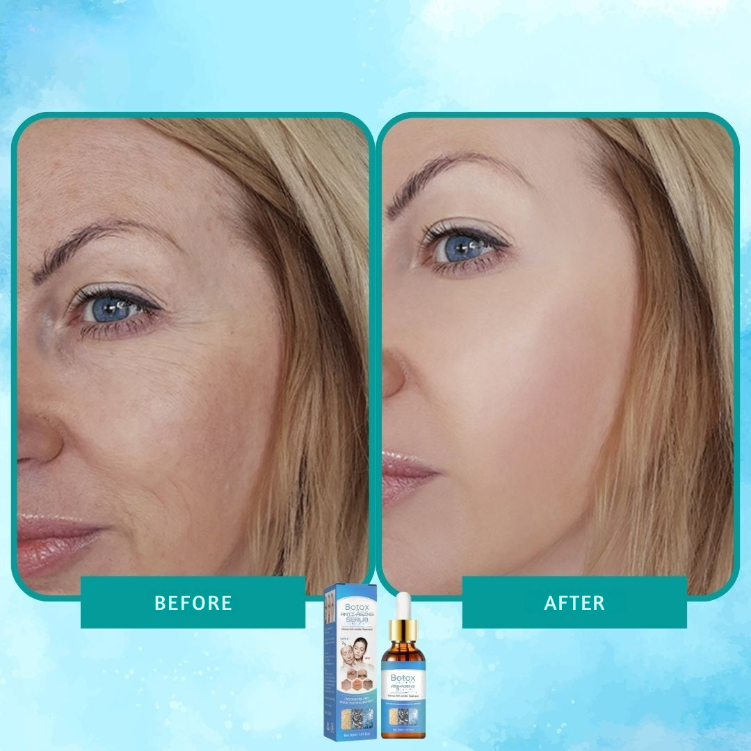 Sérum de botox elixir antiarrugas intenso 