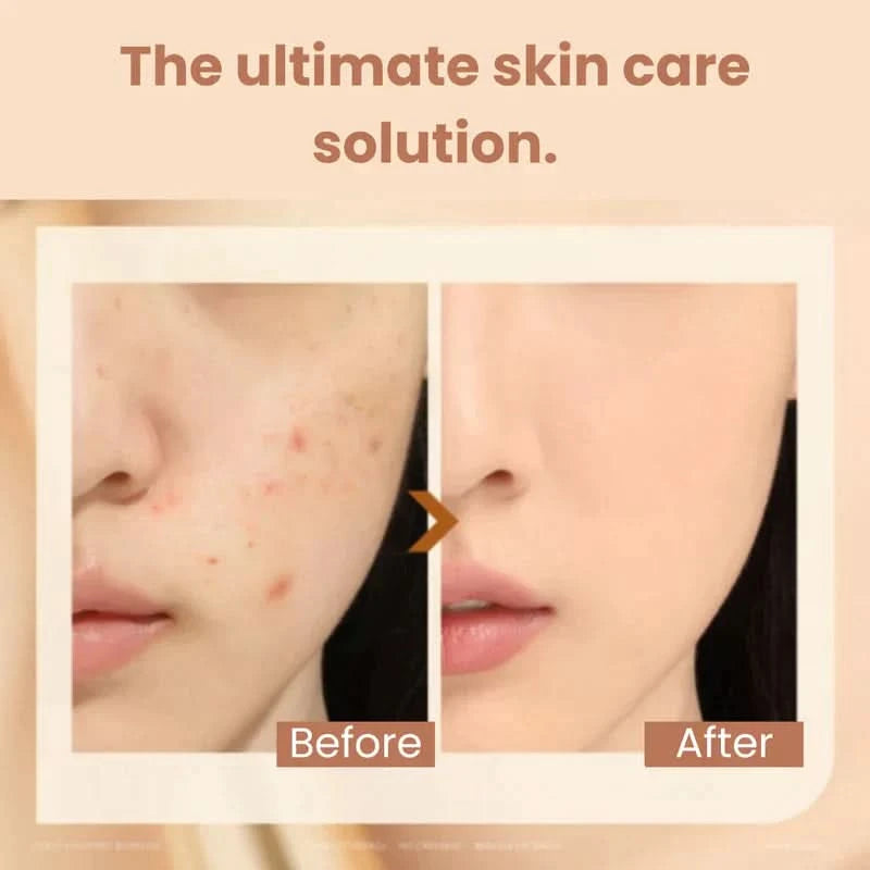 Perfecte teint en instantaan anti-rimpel effect 