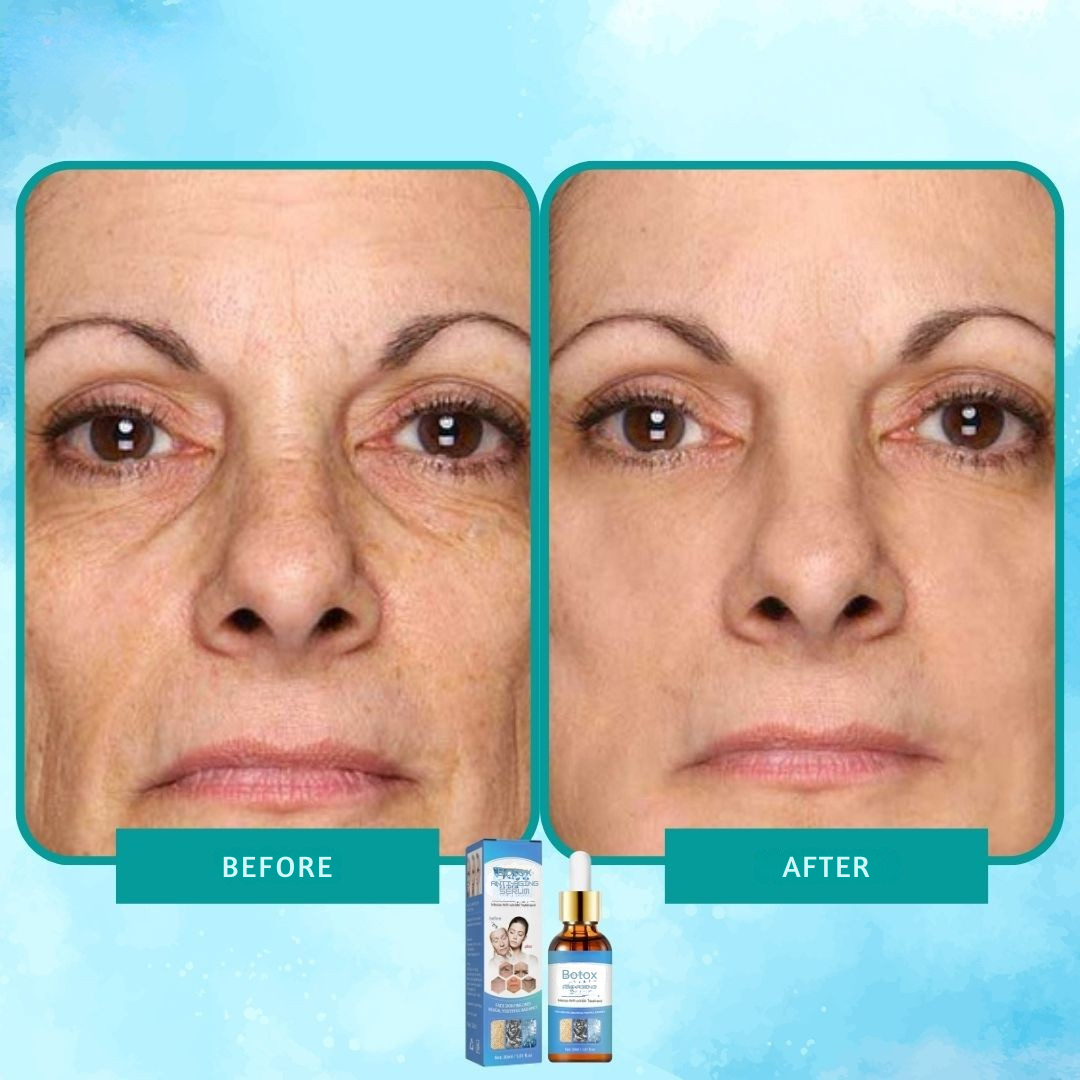 Sérum de botox elixir antiarrugas intenso 